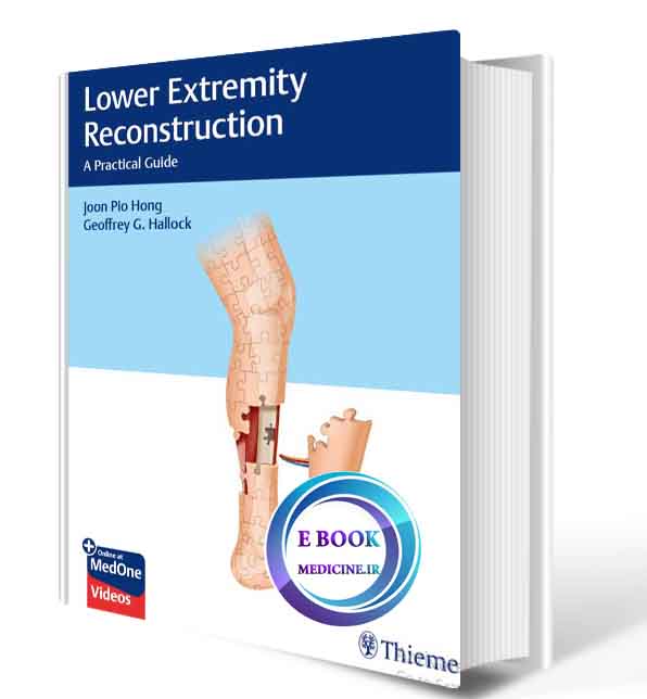 دانلود کتابLower Extremity Reconstruction: A Practical Guide 1st 2020 (ORIGINAL PDF)